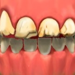 full_mouth_rotation_01-1
