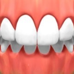 full_mouth_rotation_02-1